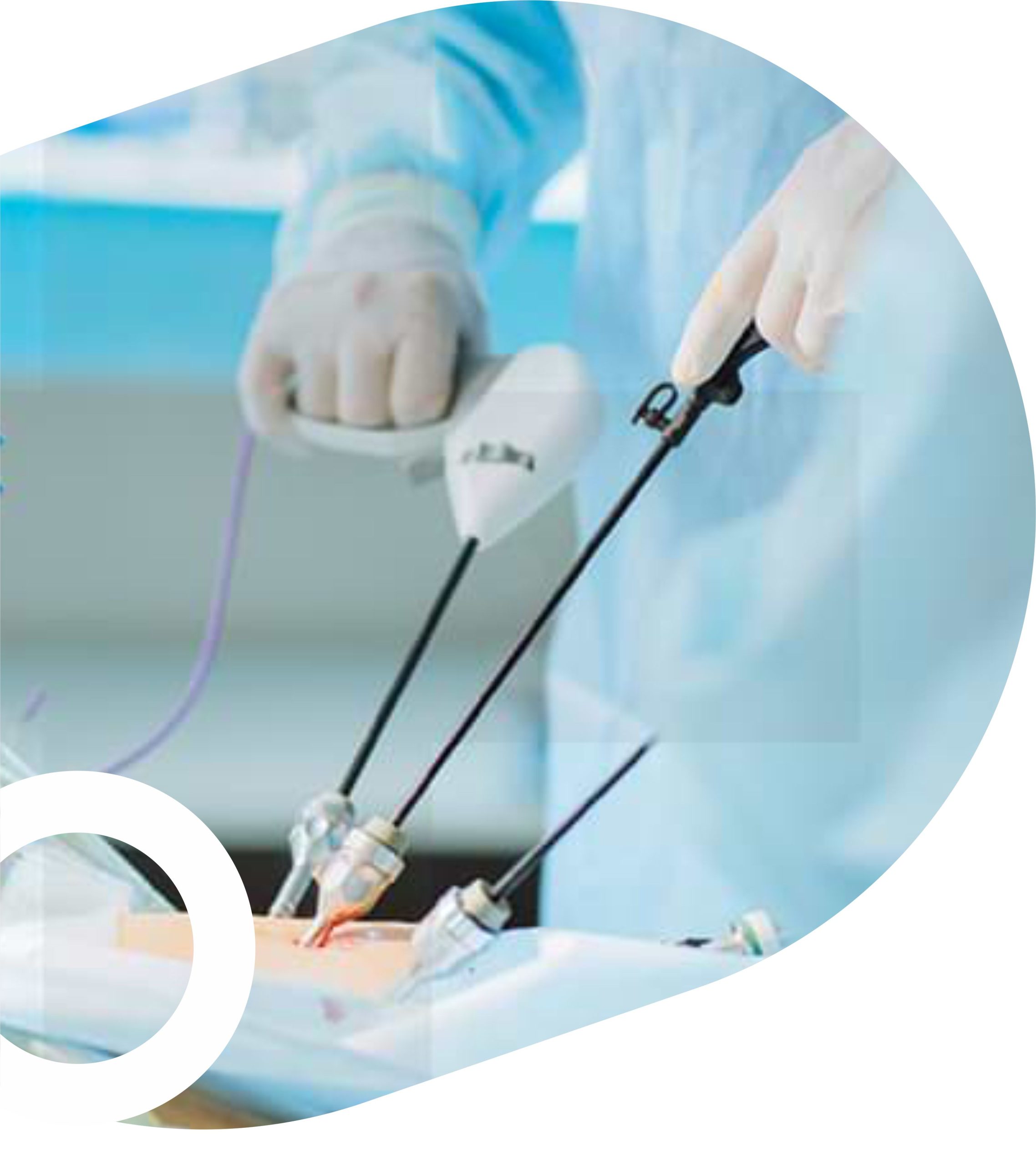 laparoscopic surgery