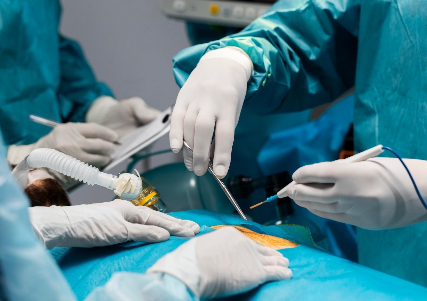 Best Gallbladder Surgery in Navi Mumbai: Laparoscopic Cholecystectomy Explained