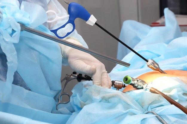 Laser Proctology